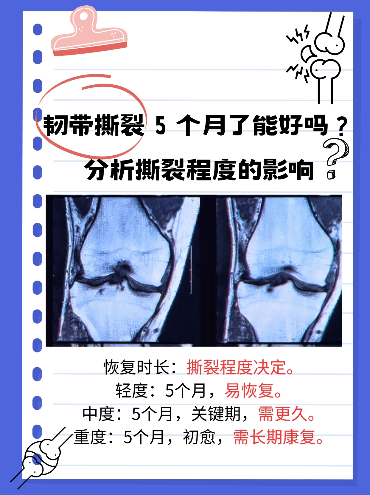 穆西亚拉腓骨骨折+韧带受伤预计伤缺4-5个月的简单介绍